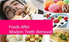 Wisdom Teeth Your Complete Guide